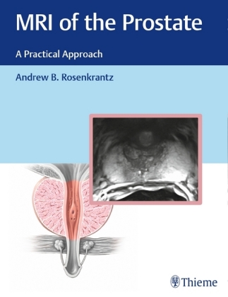 MRI of the Prostate