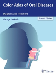 Color Atlas of Oral Diseases