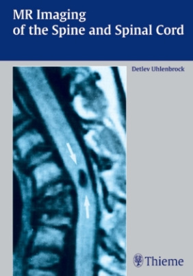 MR Imaging of the Spine and Spinal Cord