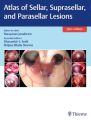 Atlas of Sellar, Suprasellar and Parasellar Lesions